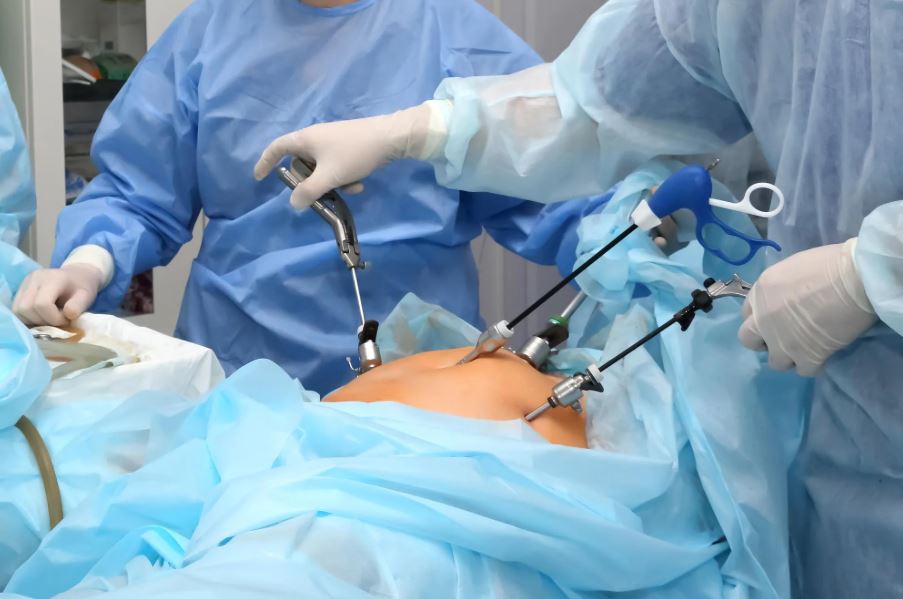 Laparoscopic Surgery in Thane: A Modern Approach to Safer, Faster Recovery