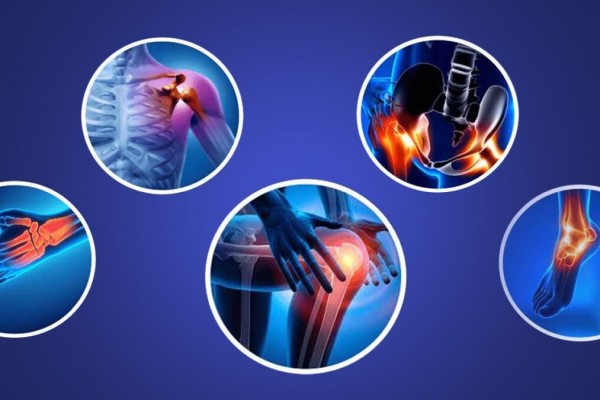 10 Most Common Orthopedic Conditions Treated at Mercurrey Hospital, Thane