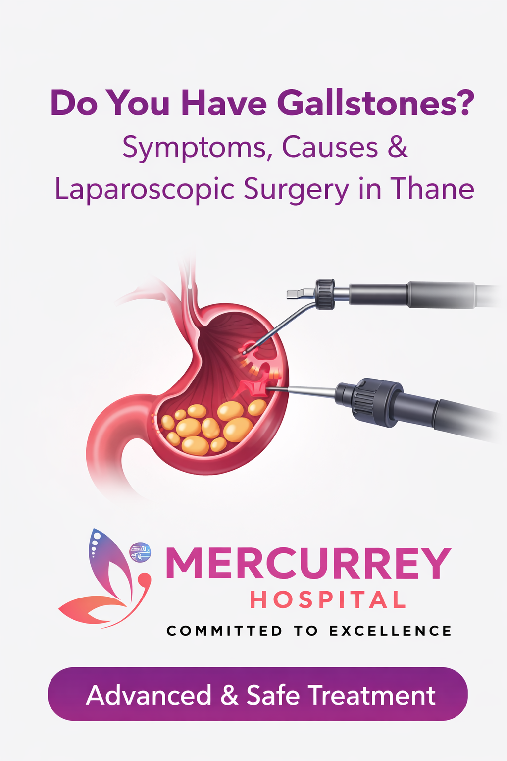Do You Have Gallstones? Know Symptoms, Causes and Laparoscopic Surgery in Thane