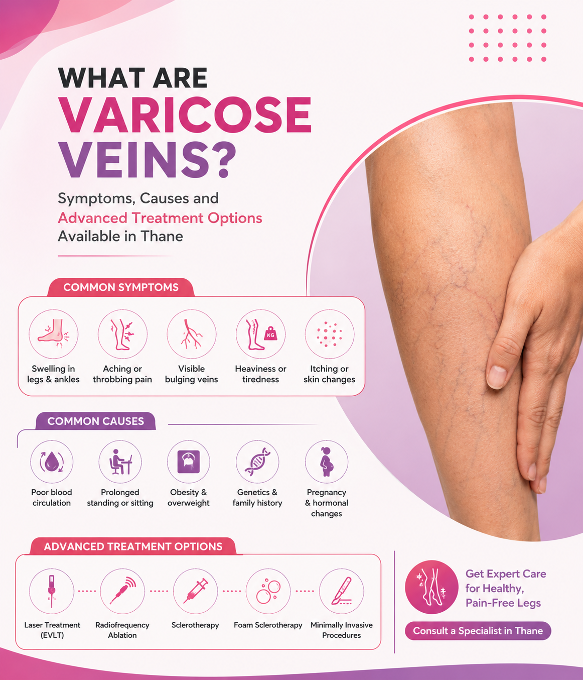 What Are Varicose Veins? Symptoms, Causes and Advanced Treatment Options Available in Thane