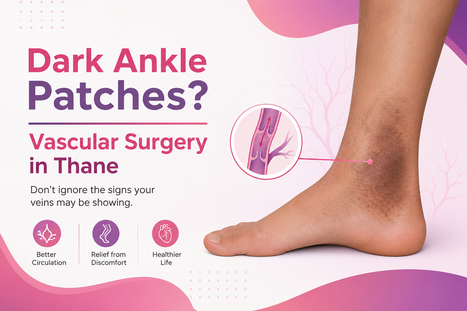 Vascular Surgery in Thane: Why Some People Develop Dark Patches Near Their Ankles